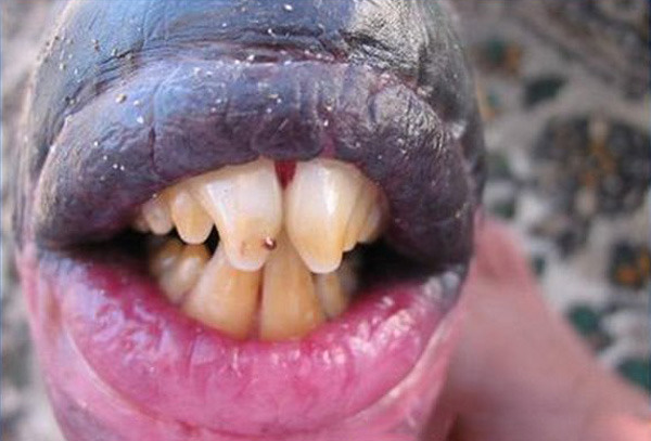 好丑啊!长着人类牙齿的恐怖怪鱼